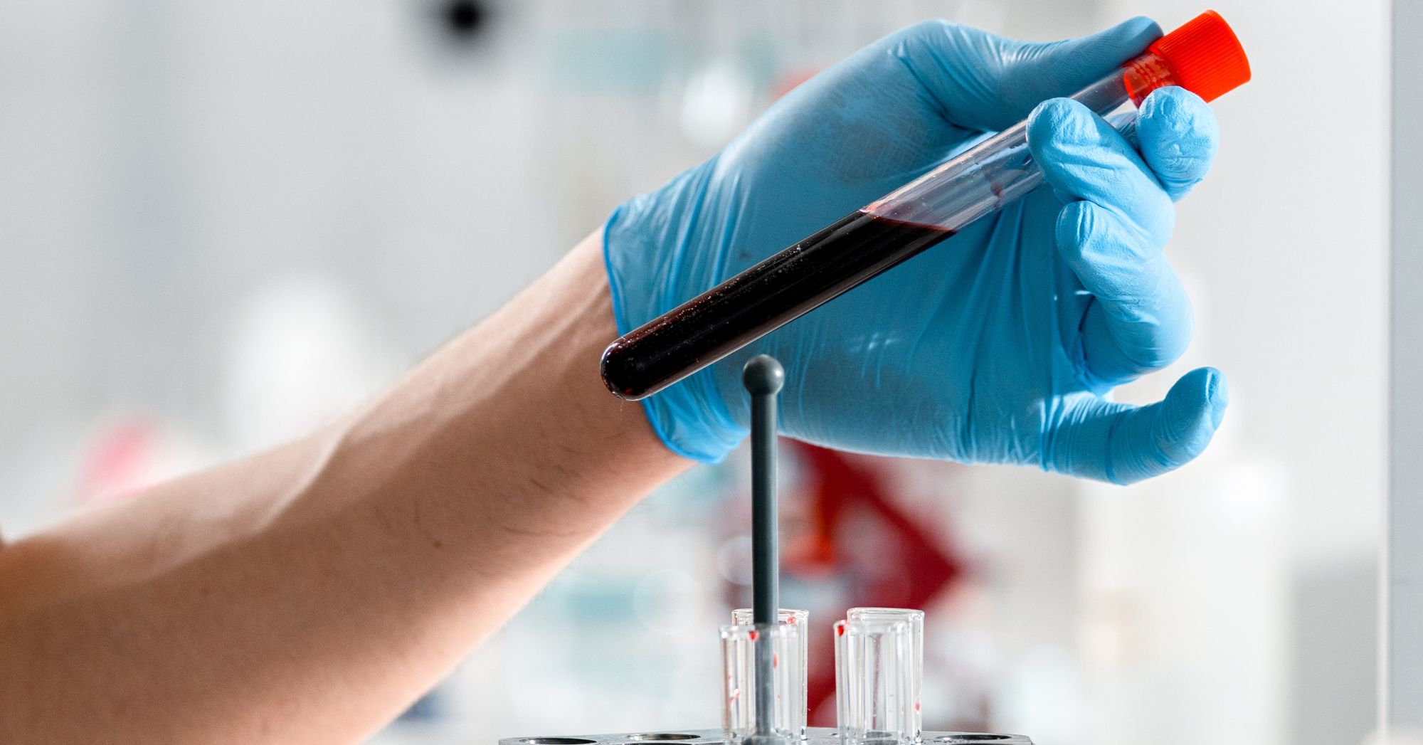 Feeling Off Lately? A Nutrient Deficiency Test Could Be the Answer