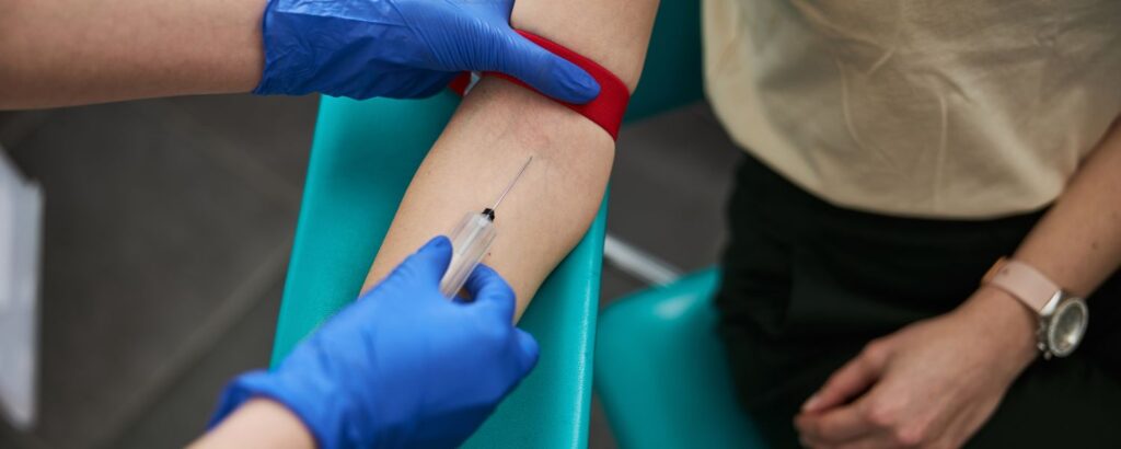 Should You Take a Vitamin B12 Test