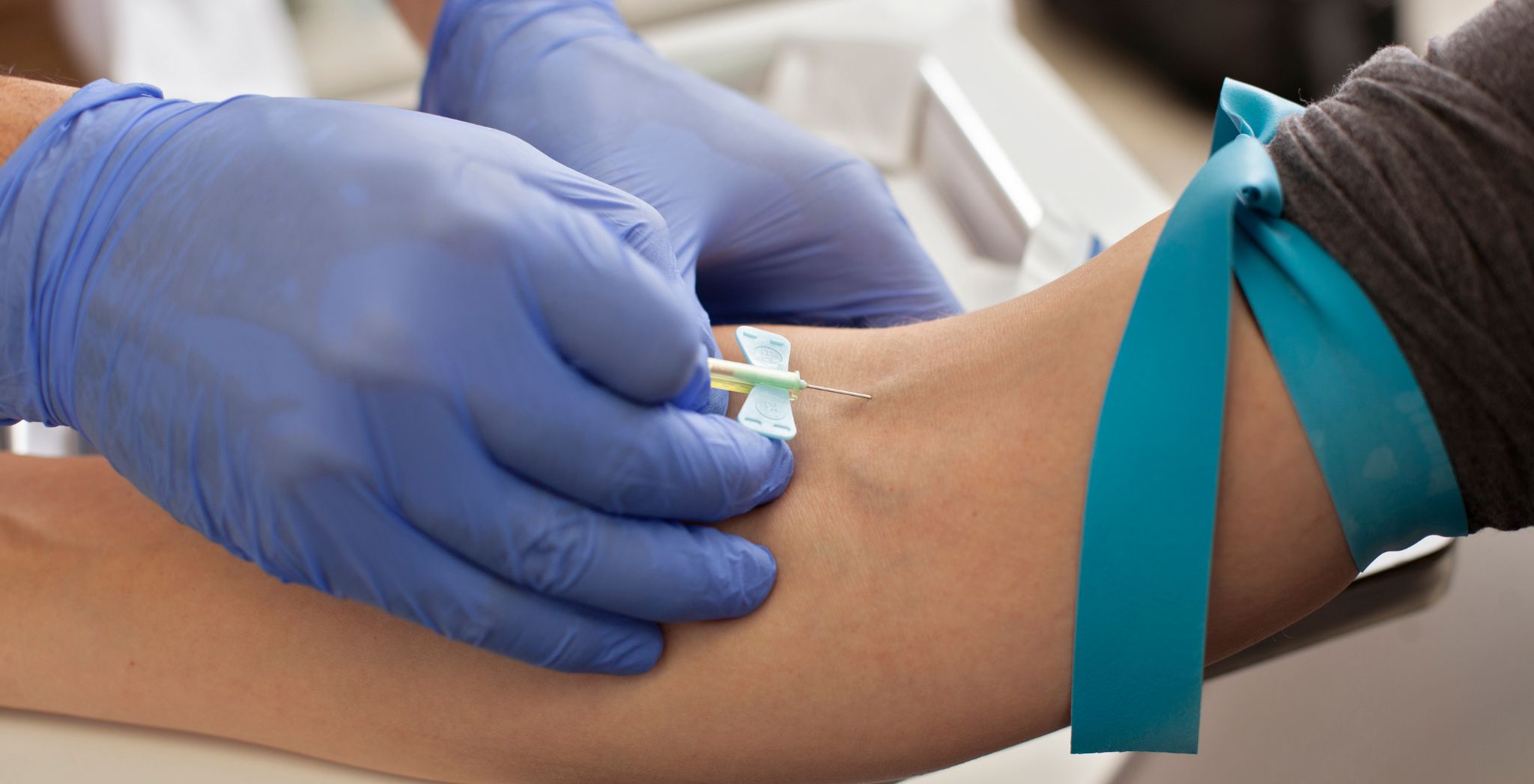 Vitamin D Test Why It Matters & How It Works